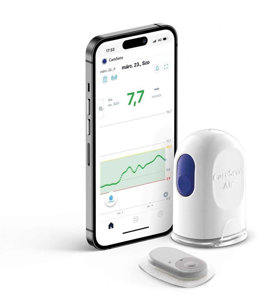 cukormonitorozó rendszer